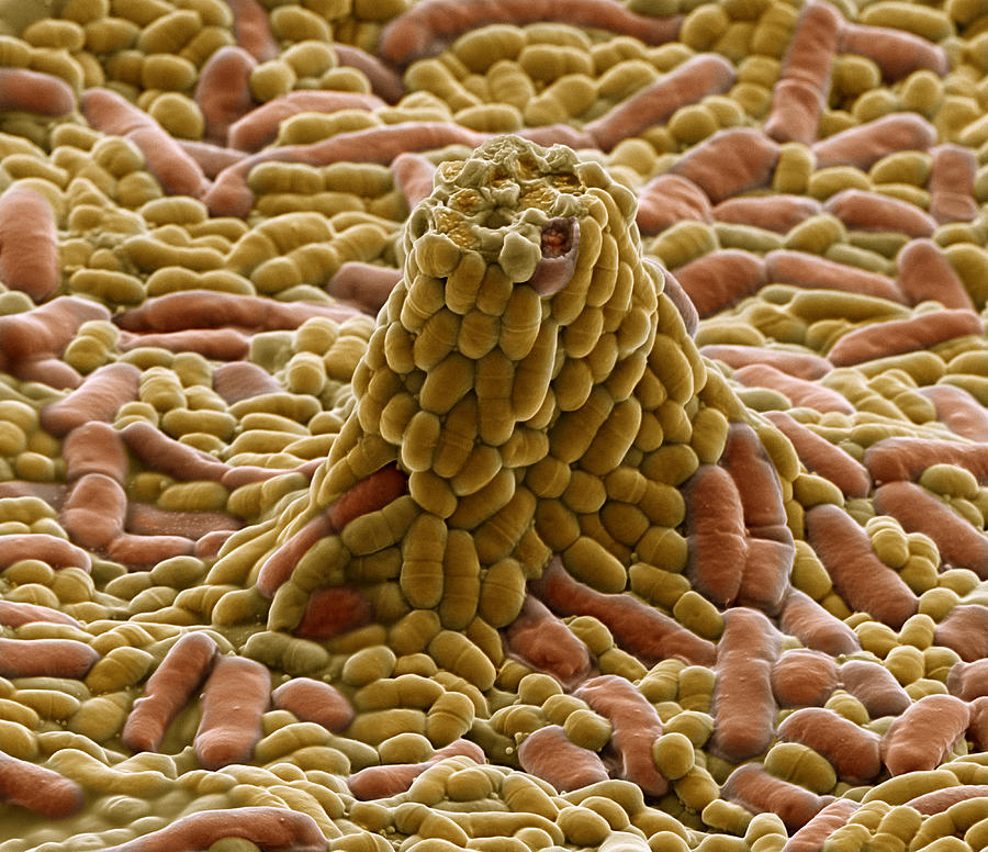 Probiotic Lactobacillis Bacteria Sem #3 Photograph by Meckes/ottawa