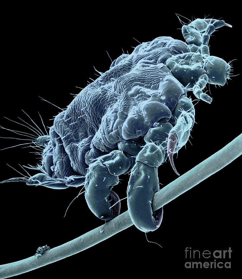 Pubic Louse Photograph By Steve Gschmeissner Science Photo Library