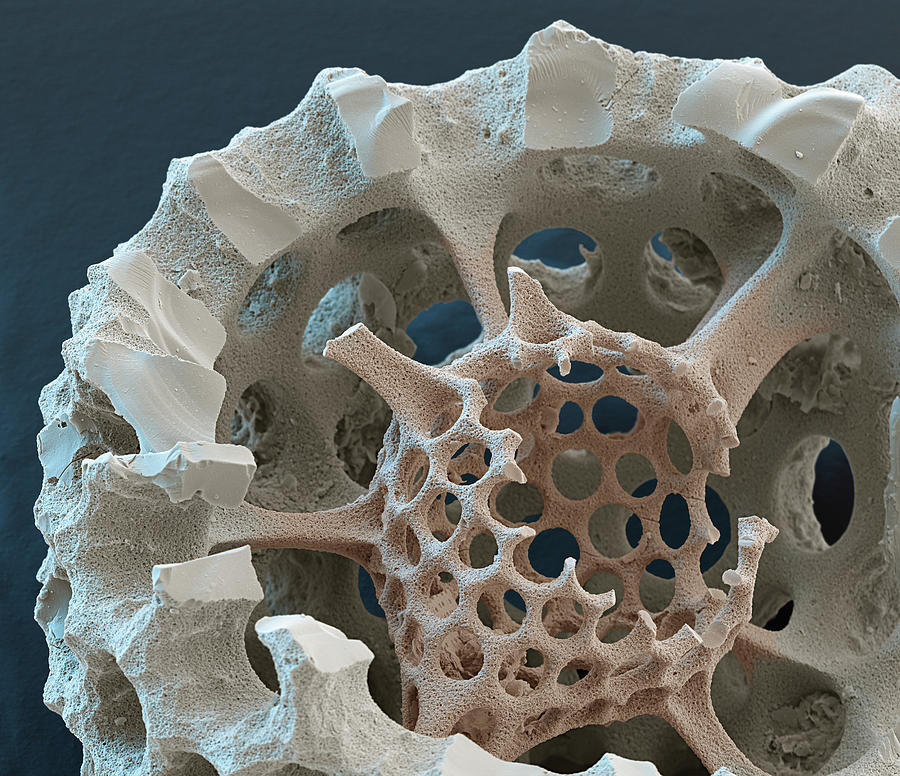 Radiolarian Stylosphæra Sp., Sem #3 Photograph by Oliver Meckes EYE OF SCIENCE
