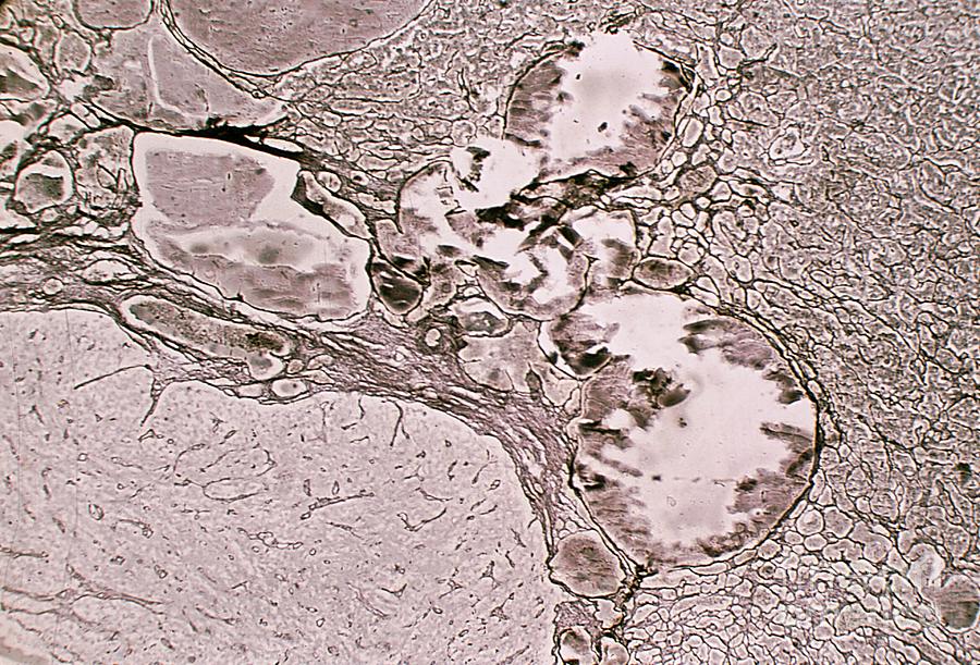 Reticular Fibres In Human Pituitary Gland Photograph By Jose Calvo