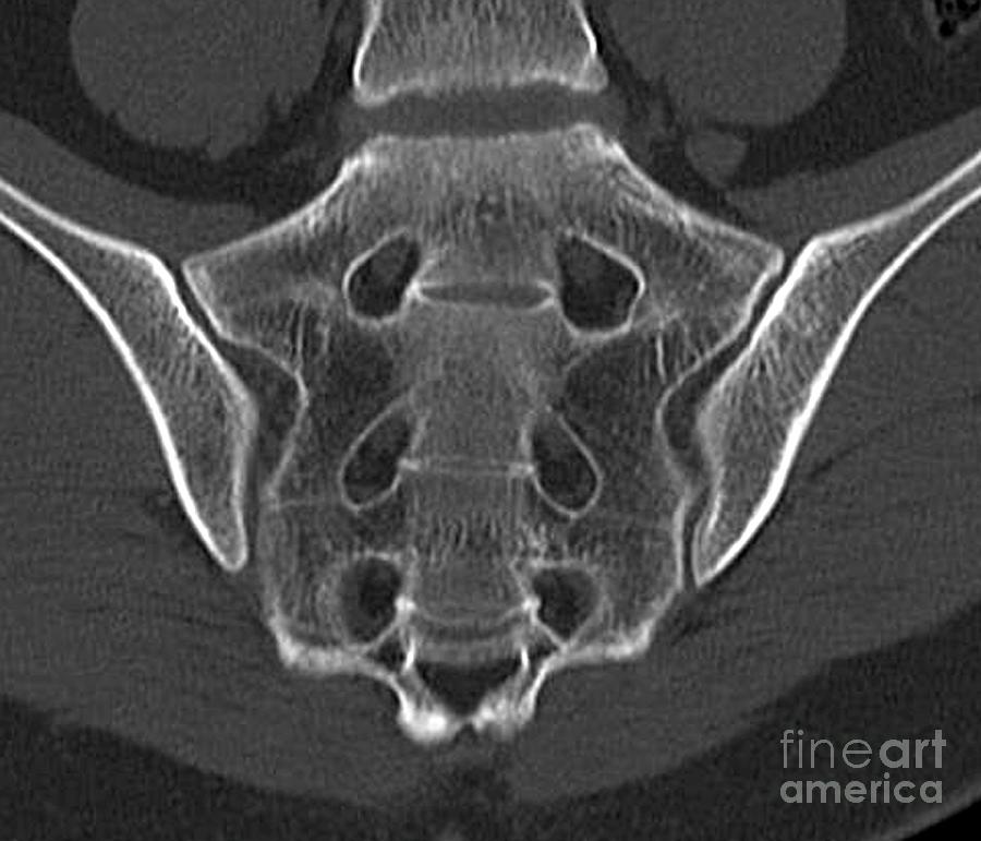 Sacrum #3 by Zephyr/science Photo Library