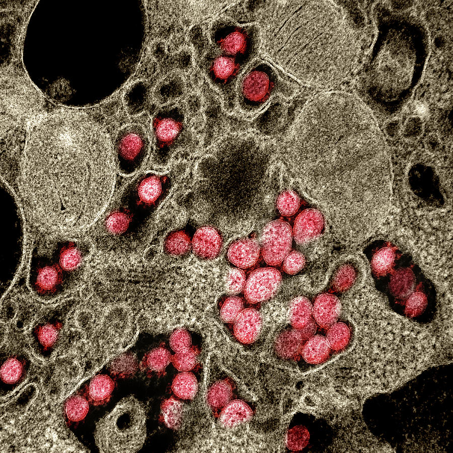 Sars-cov-2, Covid-19 Virus, Tem #3 Photograph by Science Source