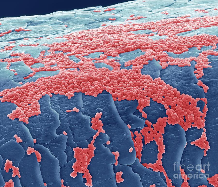 Skin Bacteria On Hair Photograph by Steve Gschmeissner/science Photo ...