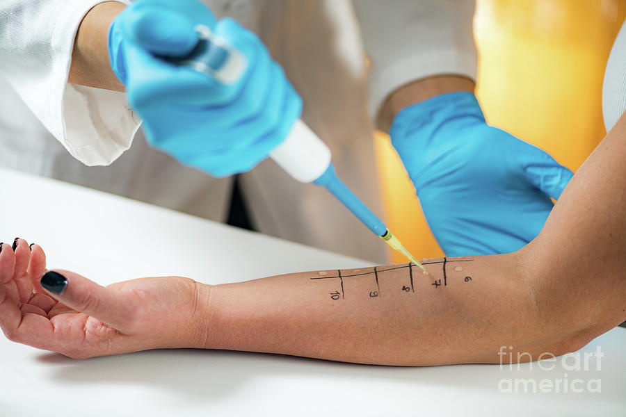Skin Prick Testing #3 Photograph by Microgen Images/science Photo Library