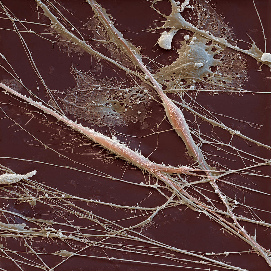 Spinal Ganglion Nerve Fibers Sem #3 Photograph by Meckes/ottawa