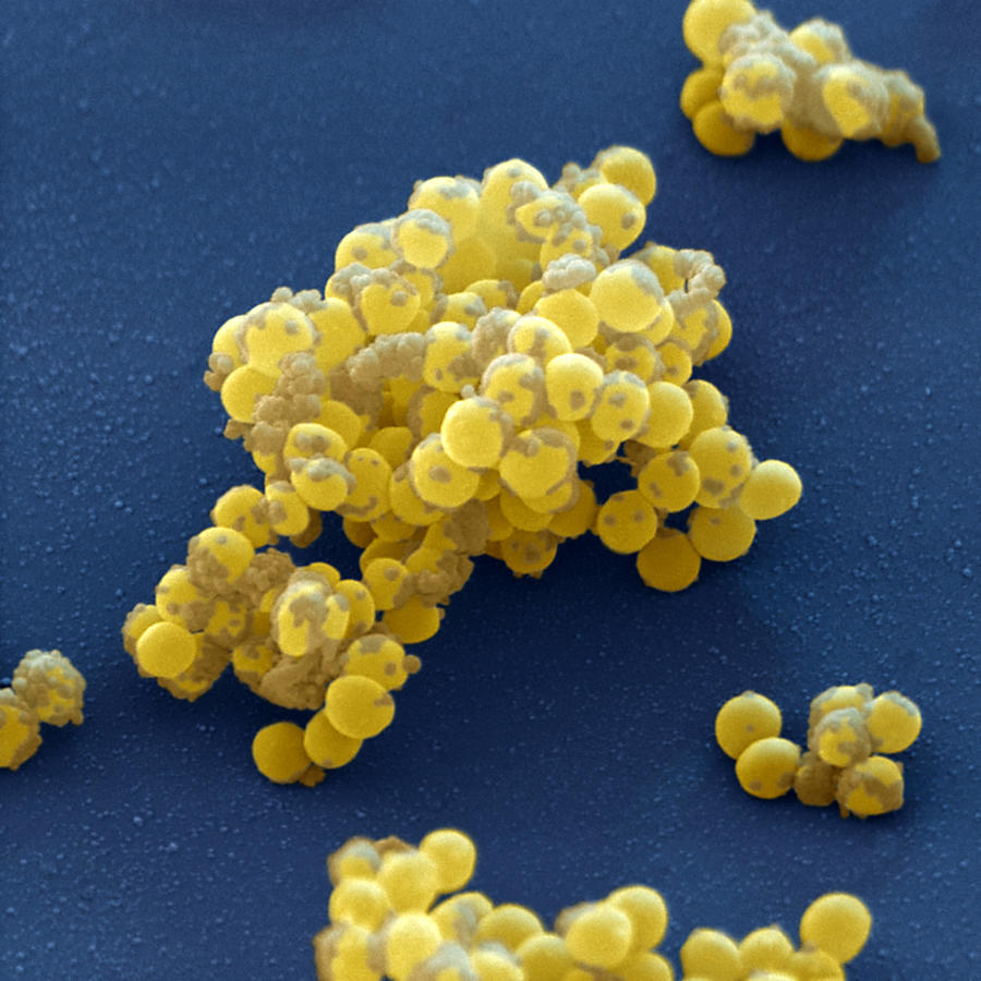 Staphylococcus Aureus #3 Photograph by Meckes/ottawa