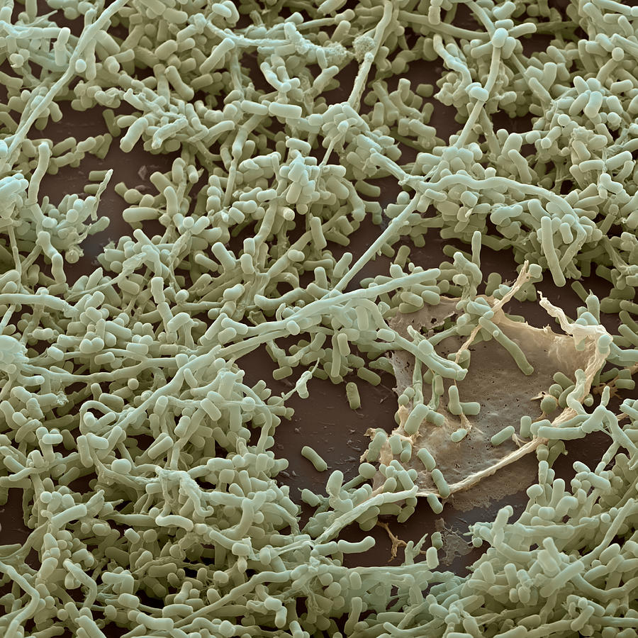 Streptomyces Sp., Sem #3 Photograph by Meckes/ottawa