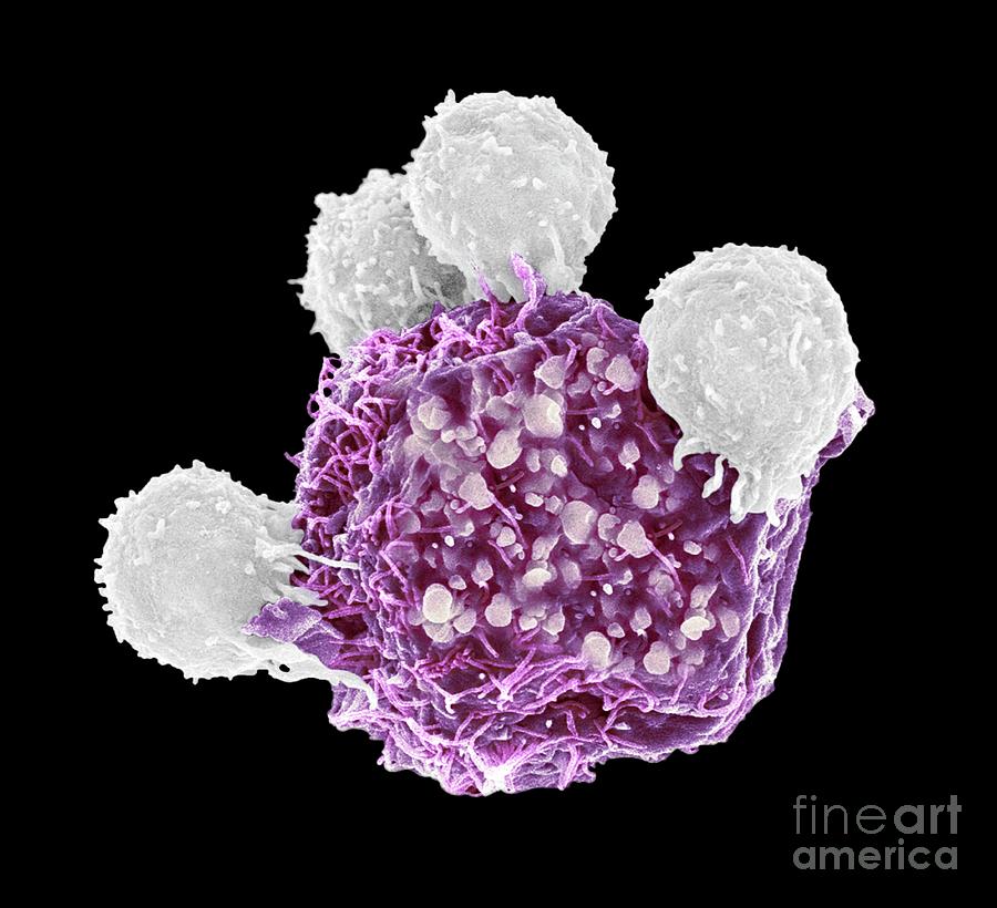 T Lymphocytes And Cancer Cell #3 Photograph by Steve Gschmeissner/science Photo Library