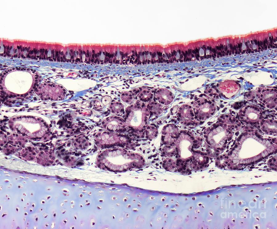 Trachea Photograph by Steve Gschmeissner/science Photo Library - Pixels