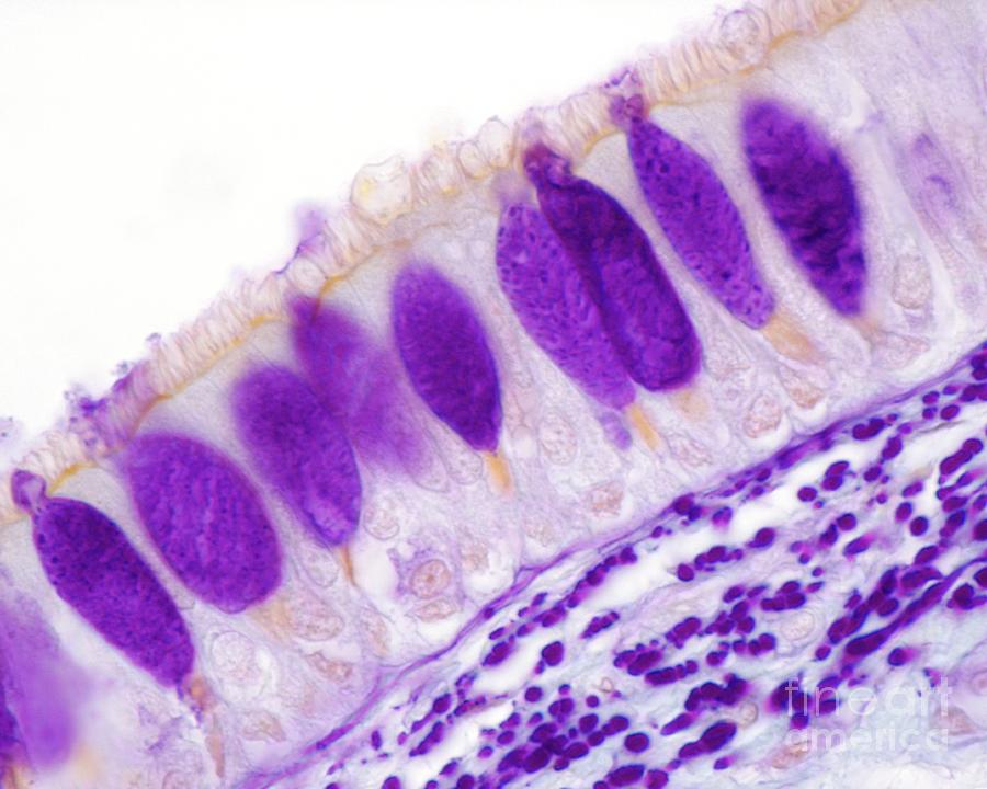 Tracheal Mucosa #3 Photograph by Jose Calvo/science Photo Library