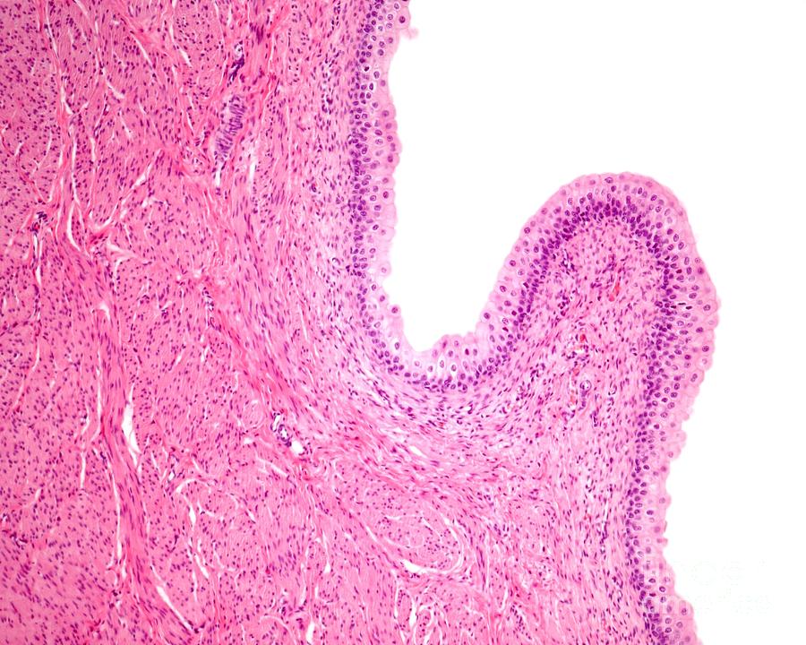 Urinary Bladder Mucosa Photograph by Jose Calvo / Science Photo Library ...