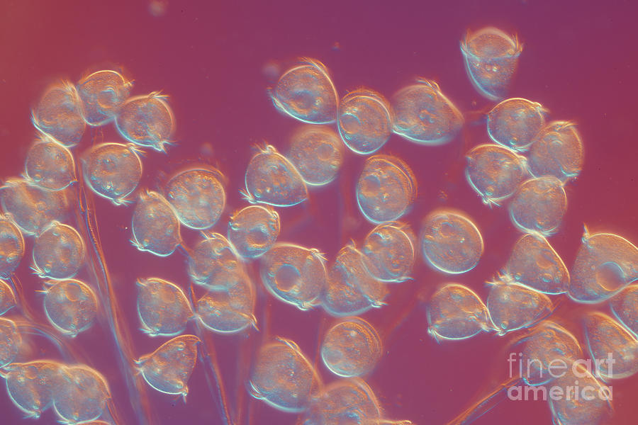 Vorticella Peritrich #3 by Karl Gaff / Science Photo Library