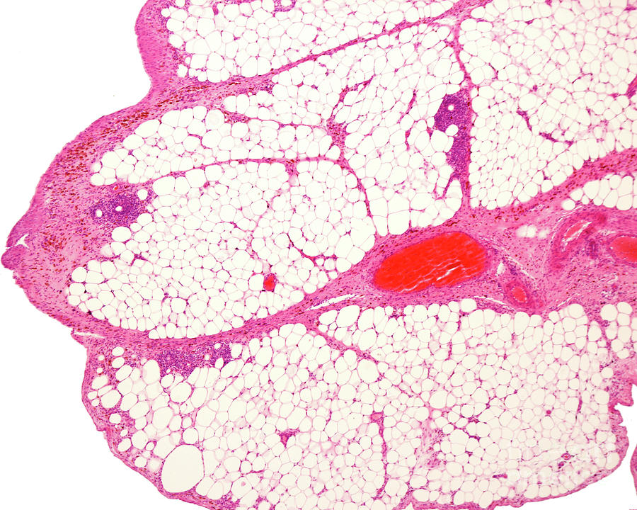White Adipose Tissue #3 Photograph by Jose Calvo / Science Photo Library