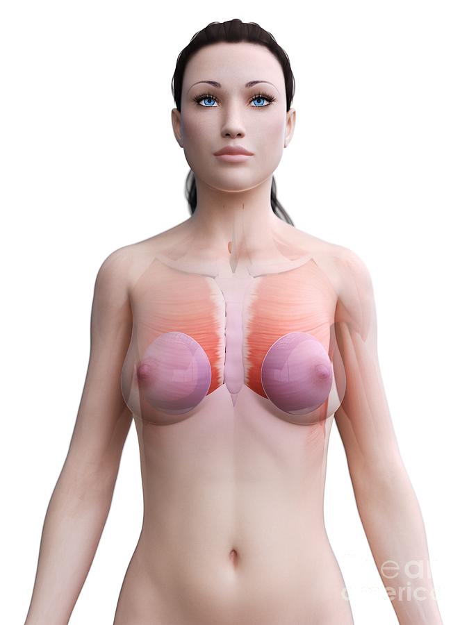Breast Implants #30 by Sebastian Kaulitzki/science Photo Library