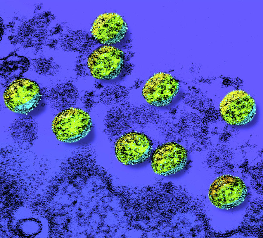 Sars-cov-2, Covid-19 Virus, Tem #30 Photograph by Science Source