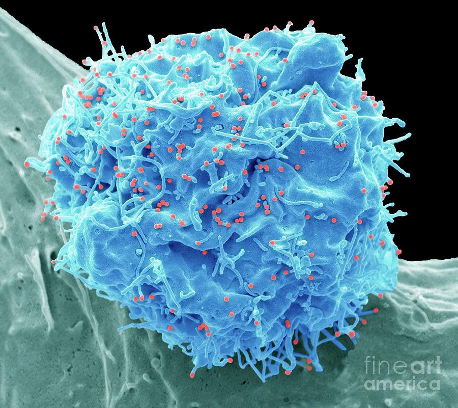 Aids Photograph - Hiv Infected Cell #31 by Steve Gschmeissner/science Photo Library