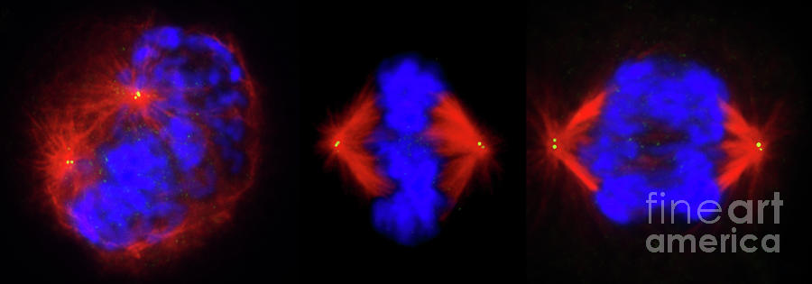 Mitosis #31 Photograph by Dr. Juan F. Gimenez-abian / Science Photo Library