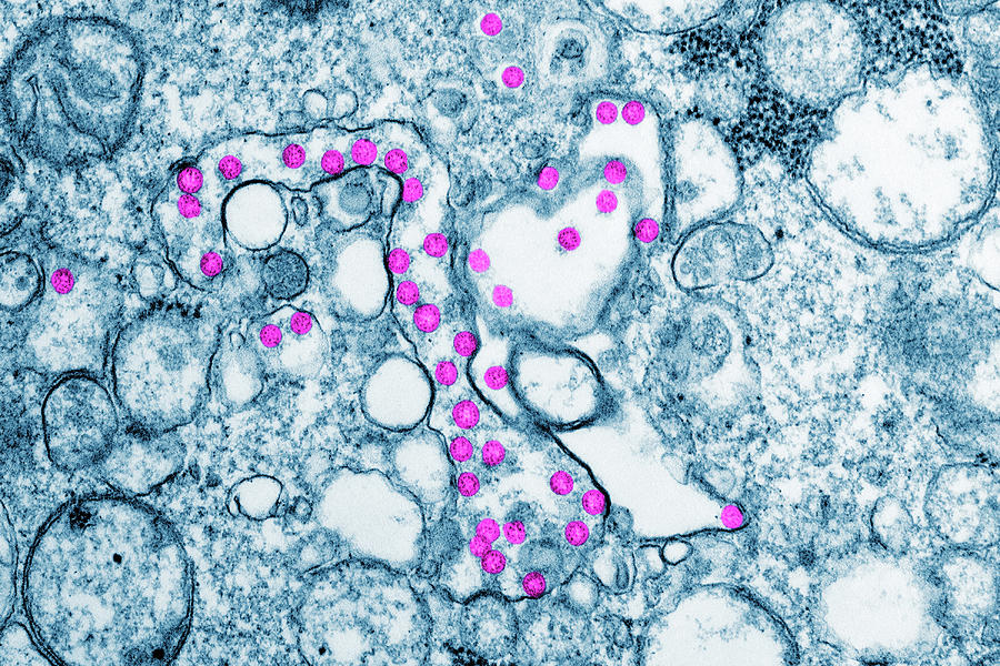 Sars-cov-2, Covid-19 Virus, Tem #31 Photograph by Science Source