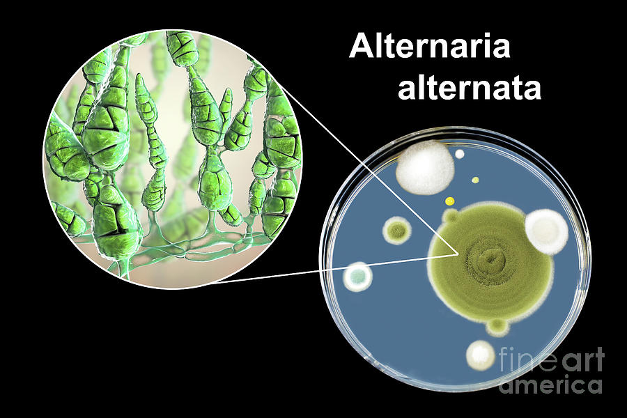 Allergenic Fungus Alternaria Alternata #33 Photograph by Kateryna Kon ...