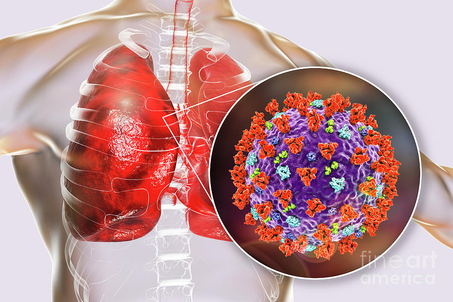 Coronavirus Disease Of The Lungs Photograph by Kateryna Kon/science ...