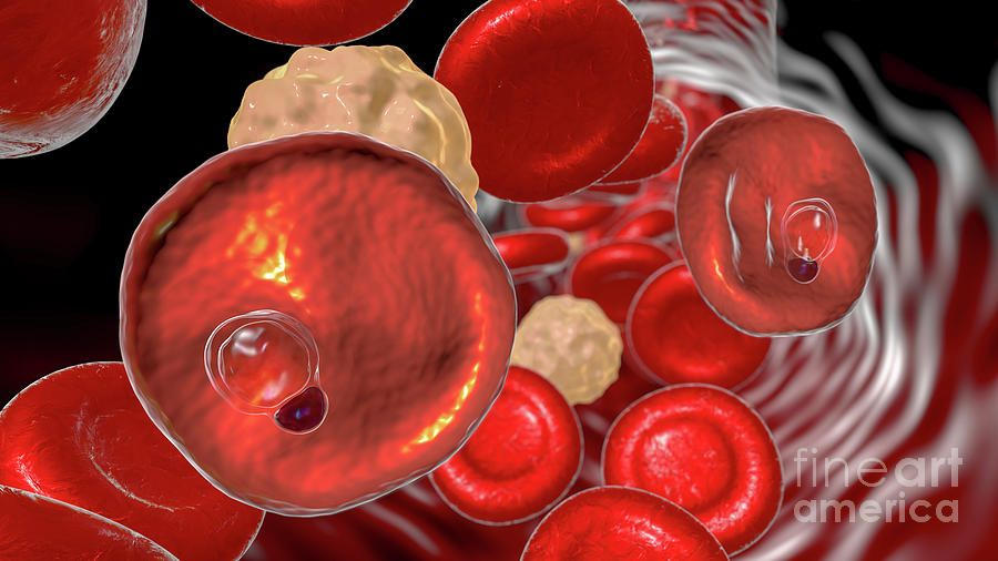 Plasmodium Vivax Inside Red Blood Cells #33 Photograph by Kateryna Kon/science Photo Library