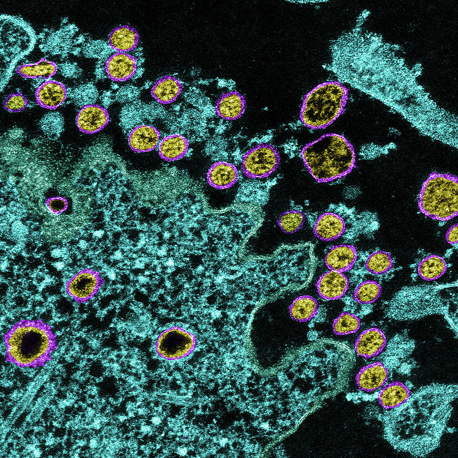 Sars-cov-2, Covid-19 Virus, Tem #33 Photograph by Science Source
