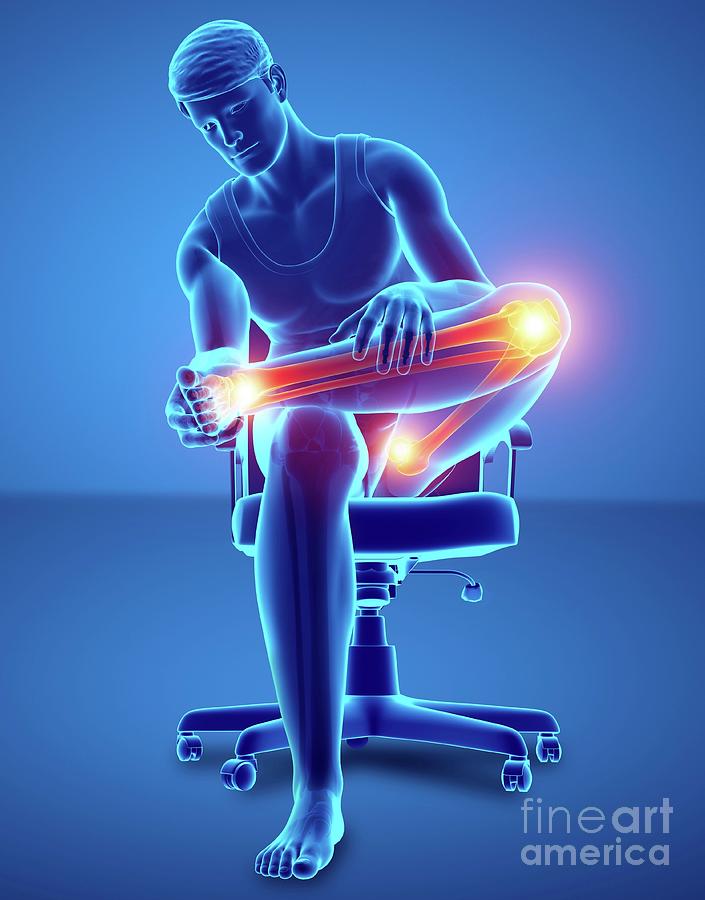 Illustration Photograph - Man With Knee Pain #34 by Pixologicstudio/science Photo Library