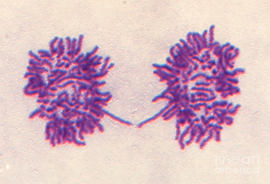 Mitosis #34 Photograph by Dr. Juan F. Gimenez-abian / Science Photo Library
