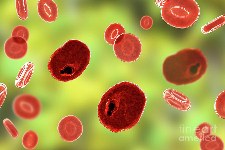 Plasmodium Ovale Inside Red Blood Cell #34 Photograph by Kateryna Kon/science Photo Library