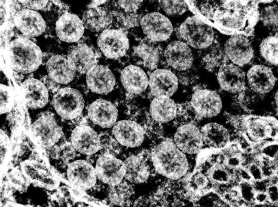 Sars-cov-2, Covid-19 Virus, Tem #34 Photograph by Science Source