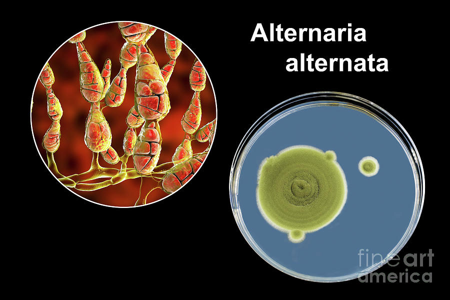 Allergenic Fungus Alternaria Alternata #37 Photograph by Kateryna Kon/science Photo Library