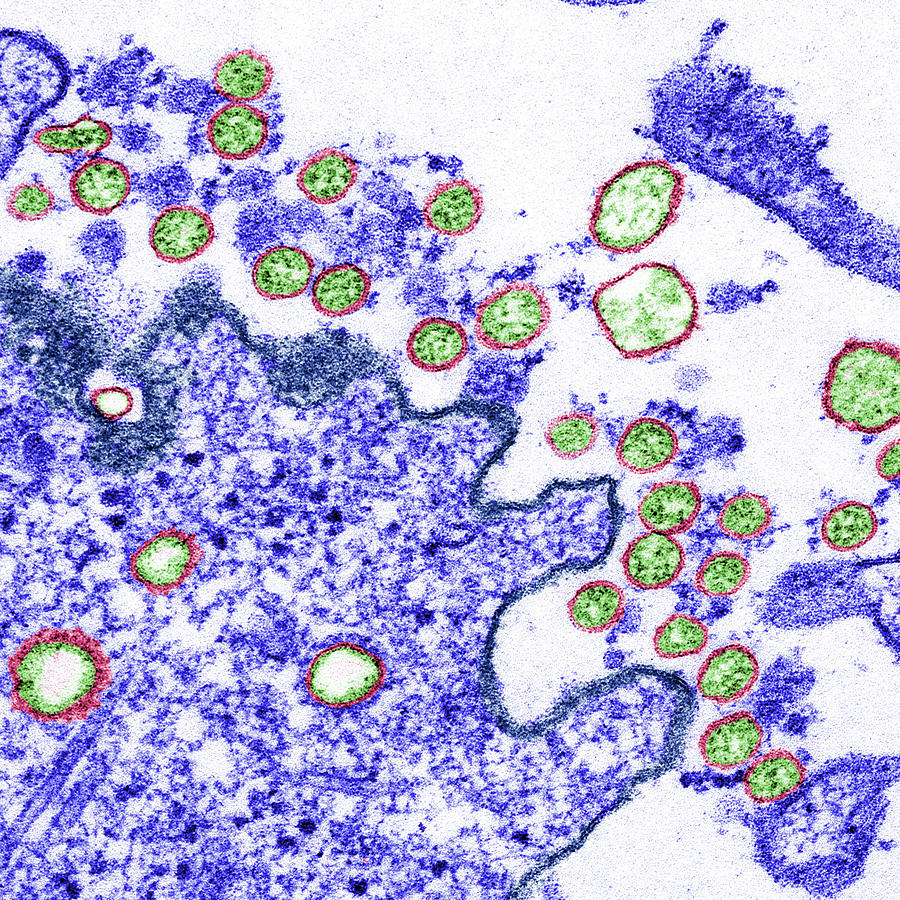 Sars-cov-2, Covid-19 Virus, Tem #37 Photograph by Science Source