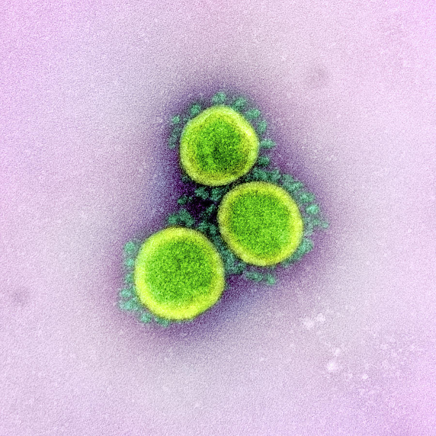 Sars-cov-2, Covid-19 Virus, Tem #38 Photograph by Science Source