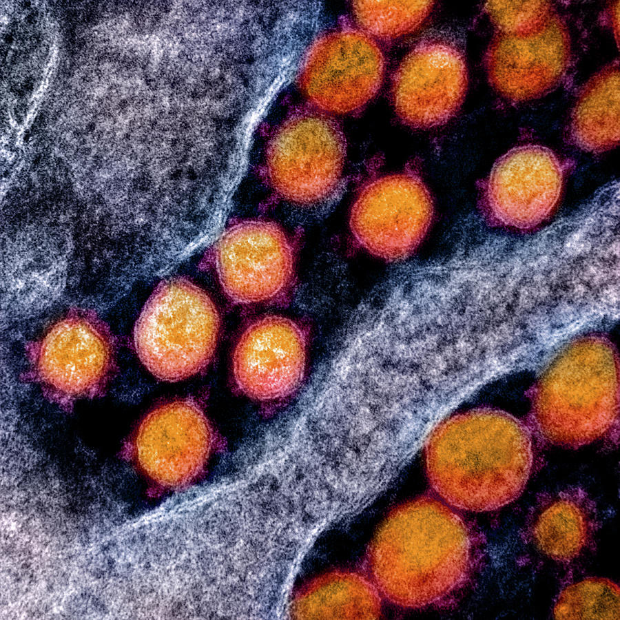 Sars-cov-2, Covid-19 Virus, Tem #39 Photograph by Science Source