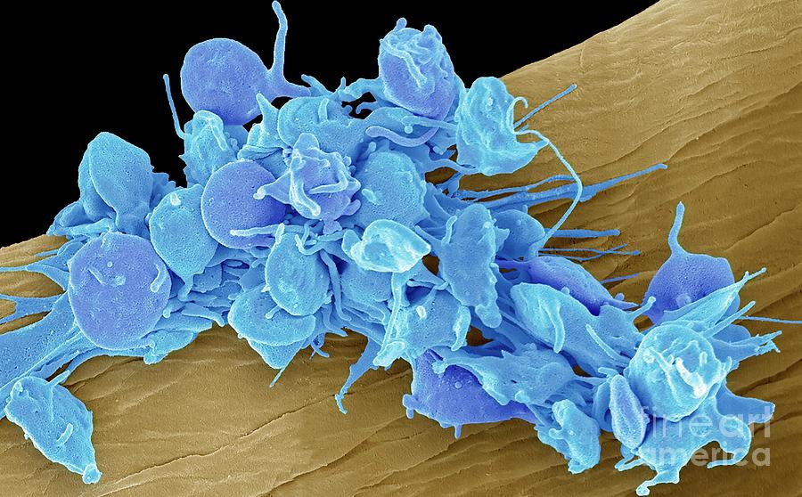 Activate Photograph - Activated Platelets #4 by Steve Gschmeissner/science Photo Library
