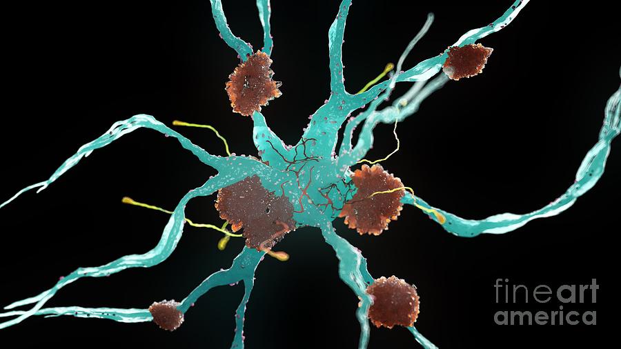 Alzheimers Nerve Cells #4 Photograph by Sebastian Kaulitzki/science Photo Library