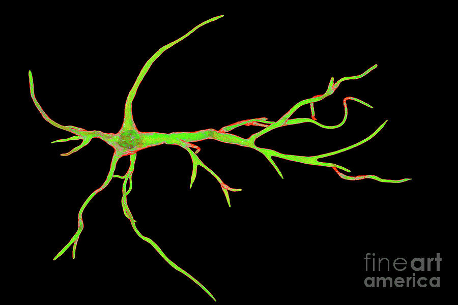 Astrocyte Nerve Cells #4 Photograph by Kateryna Kon/science Photo Library