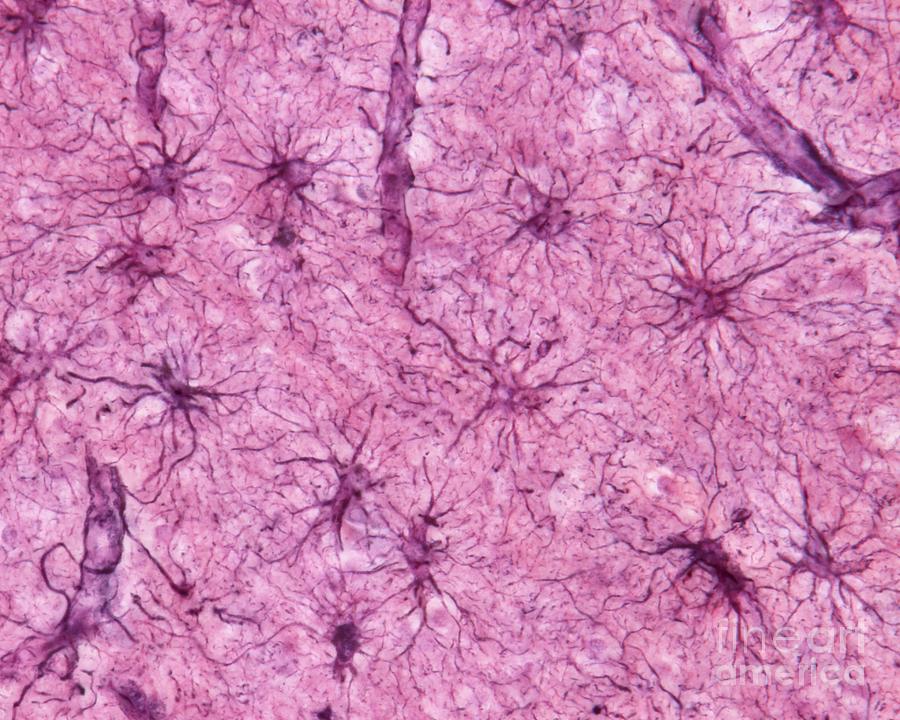 Astrocytes #4 Photograph by Jose Calvo / Science Photo Library