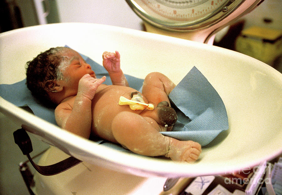 Baby Weighing #1 by Michael Donne/science Photo Library