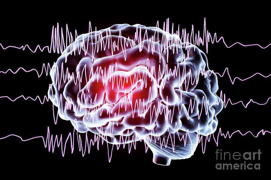 Brain And Brain Waves In Epilepsy #4 Photograph by Kateryna Kon/science Photo Library