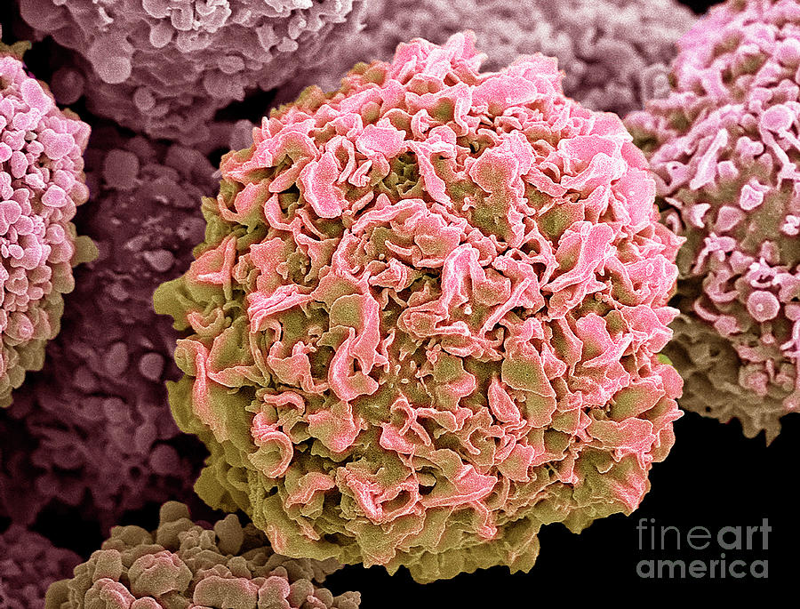 Breast Cancer Cells #4 Photograph by Steve Gschmeissner/science Photo Library