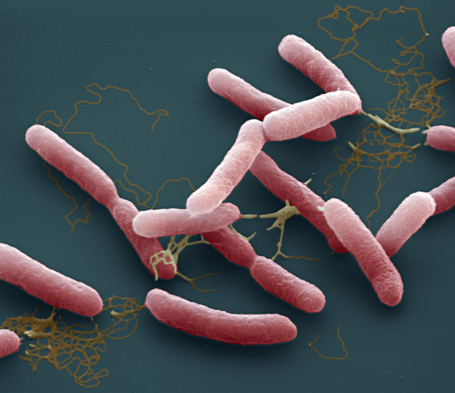 Burkholderi Pseudomallei Bacteria Photograph By Meckes Ottawa - Fine 