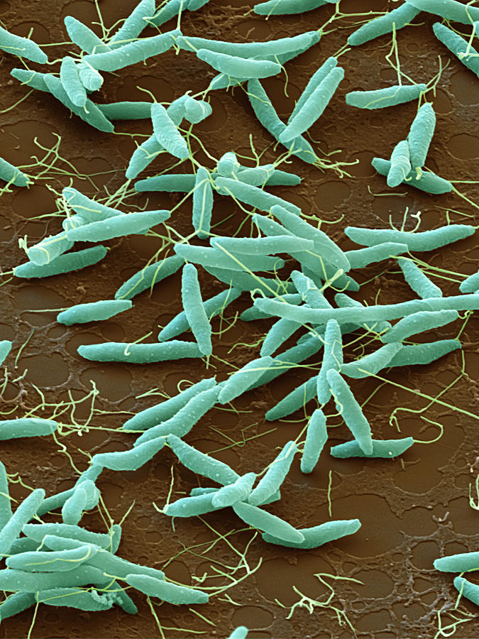 Campylobacter Jejuni, Sem #4 Photograph by Oliver Meckes EYE OF SCIENCE