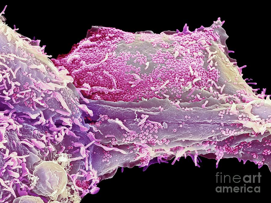 Cell Infected With Herpes Virus Photograph by Science Photo Library ...