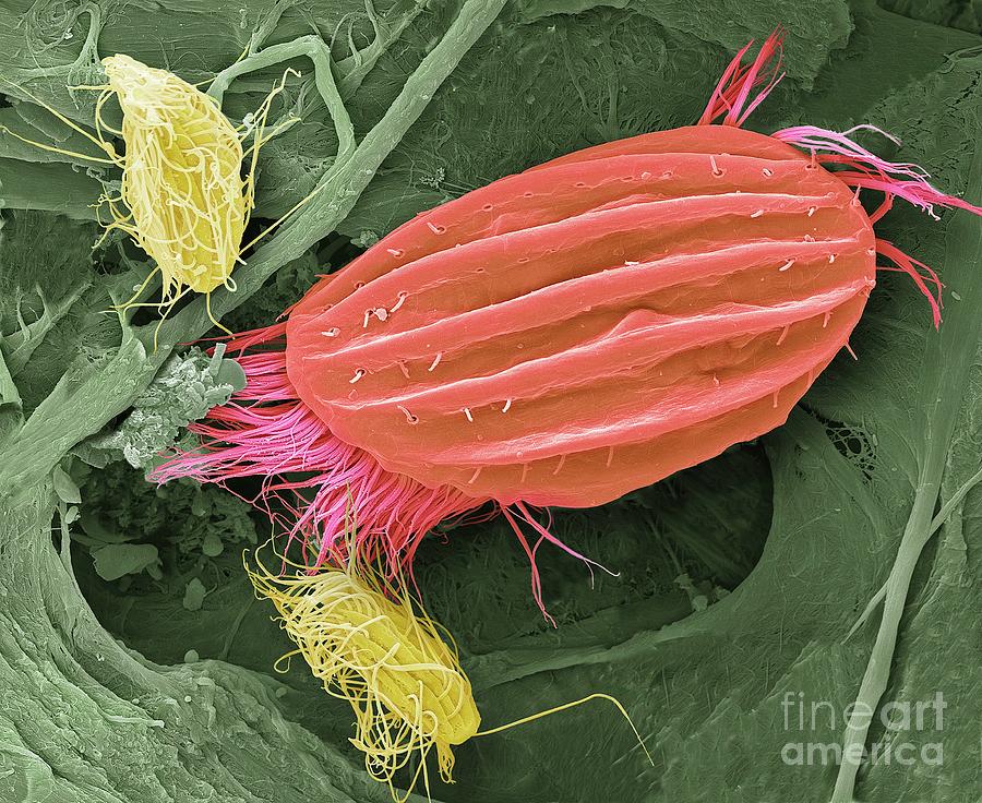 Ciliate Protozoa Photograph by Steve Gschmeissner/science Photo Library ...