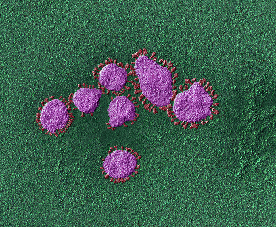 Coronavirus Developing In Cell, Tem #4 Photograph by Oliver Meckes EYE OF SCIENCE
