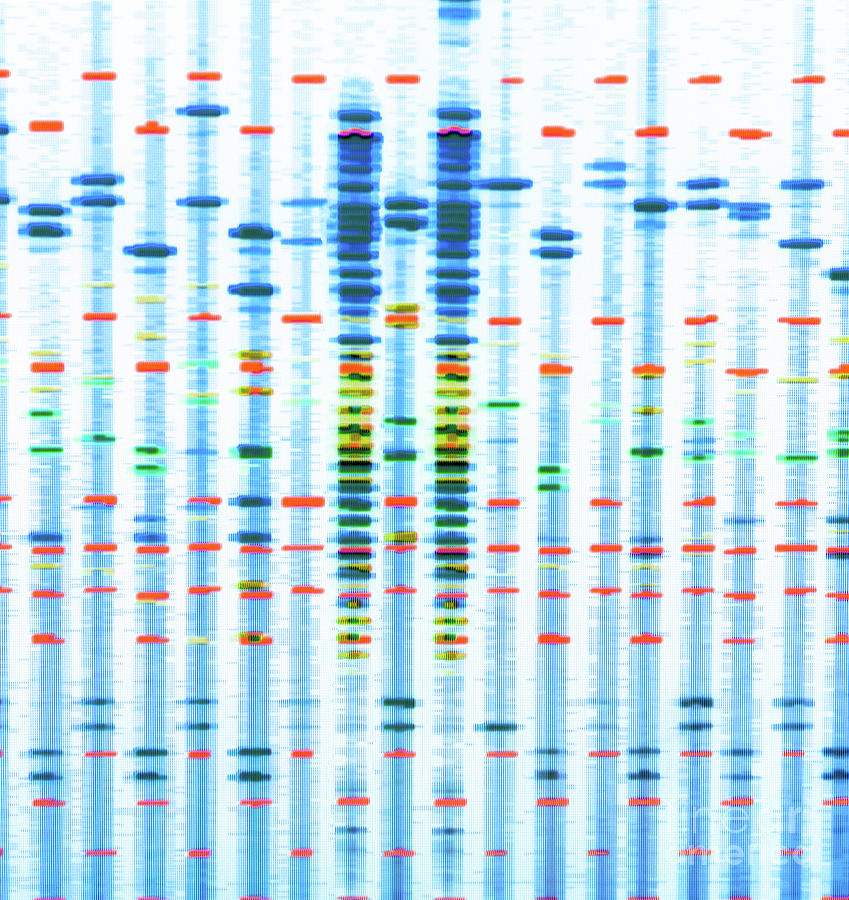 Dna Profile #4 Photograph by Tek Image/science Photo Library