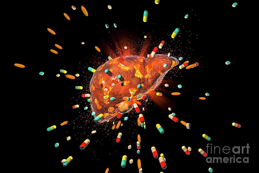Drug-induced Hepatotoxicity #4 Photograph by Kateryna Kon/science Photo Library