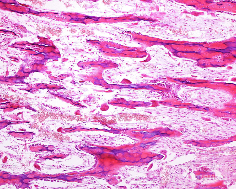Endochondral Ossification #4 Photograph by Jose Calvo / Science Photo Library