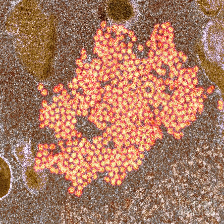 Enterovirus 68 Virions #4 Photograph by Cdc/science Photo Library